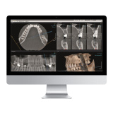 OnDemand3D - программное обеспечение для обработки снимков зубов